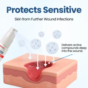 Cvreoz® Diabetes Foot Guard Recovery Spray