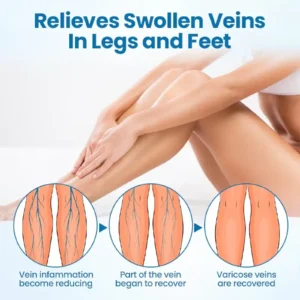 Cvreoz® VeinGuard Herbal Spray-Visible Results in 7 Days or Less