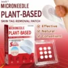 Juxek™ MicroNeedle Plant-based Skin Tag Removal Patch 🇺🇸 Made in the USA