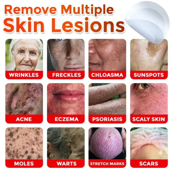Juxek™ MicroNeedle Plant-based Skin Tag Removal Patch 🇺🇸 Made in the USA