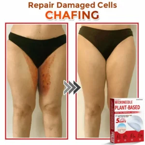 Juxek™ MicroNeedle Plant-based Skin Tag Removal Patch 🇺🇸 Made in the USA