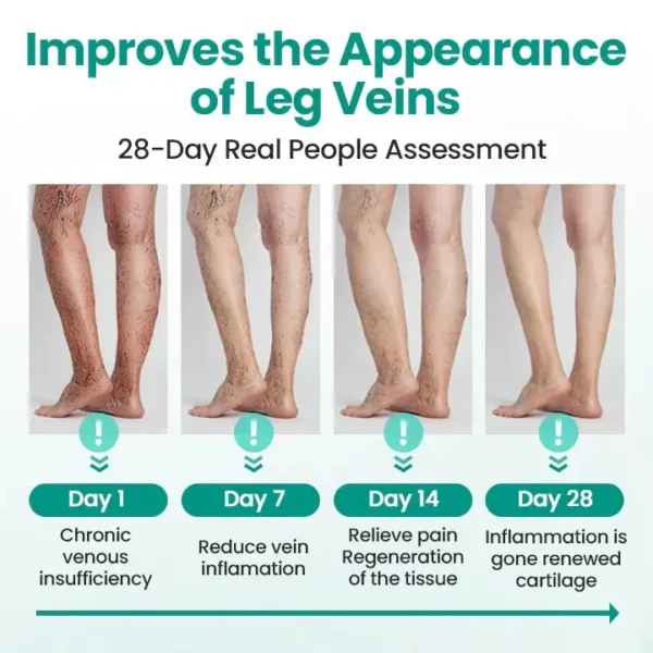 Newyuo® LegRenew Varicose Veins Patch