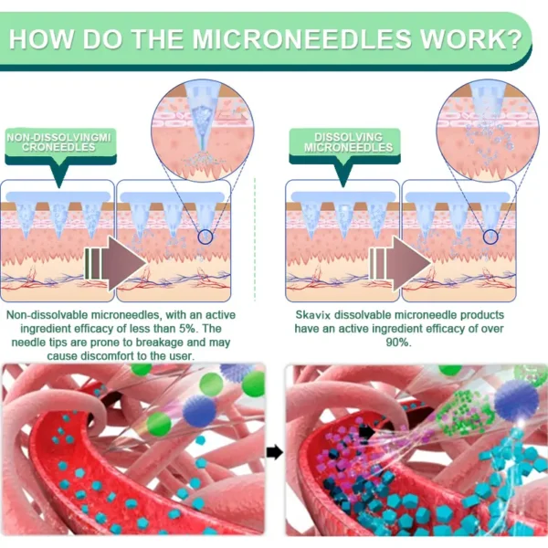 Skavix® NIDDK-Tirzepatide Slimming & health NANO MICRONEEDLE PATCH
